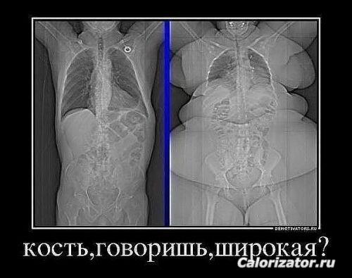 кость широкая
