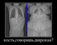 кость широкая