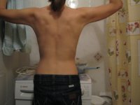 My Back
