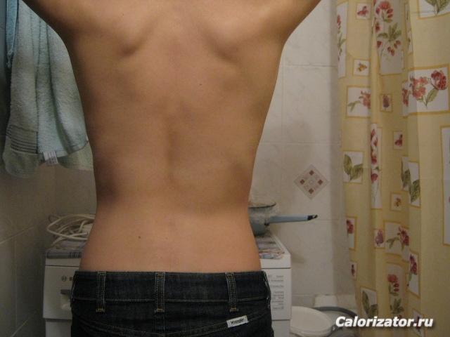 My Back