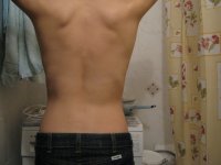 My Back