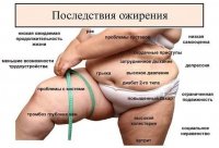 лишний вес